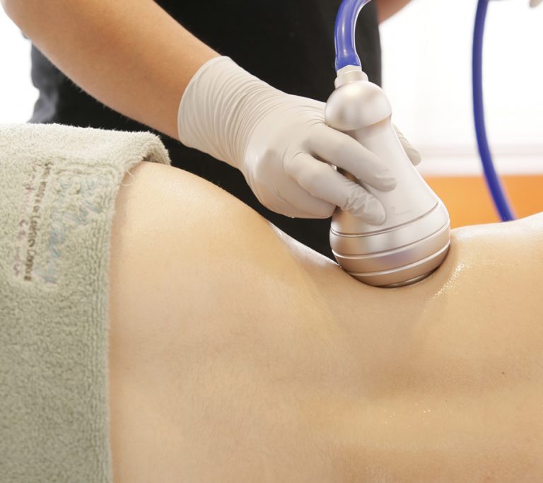 comprar Hifu profesional